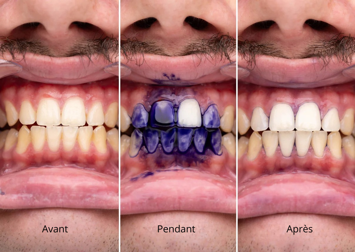 Sérum correcteur de couleur V34